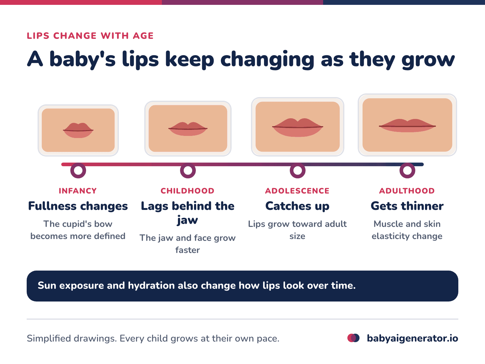 Infographic: a timeline of lip shape, with fullness and the cupid's bow changing in infancy, lip growth lagging behind the jaw in childhood, catching up in adolescence and thinning in adulthood
