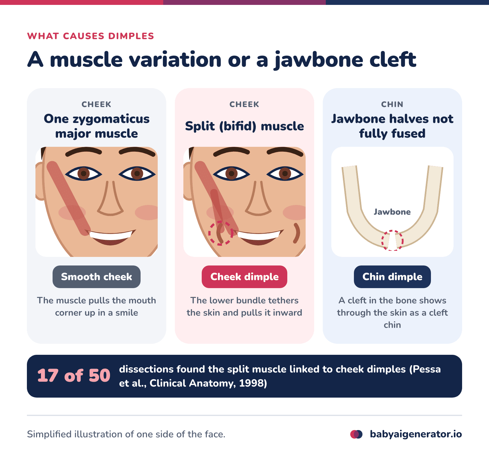 Infographic: a single zygomaticus major muscle leaves the cheek smooth, a split (bifid) muscle tethers the skin into a cheek dimple, and a jawbone whose two halves did not fully fuse leaves a chin dimple